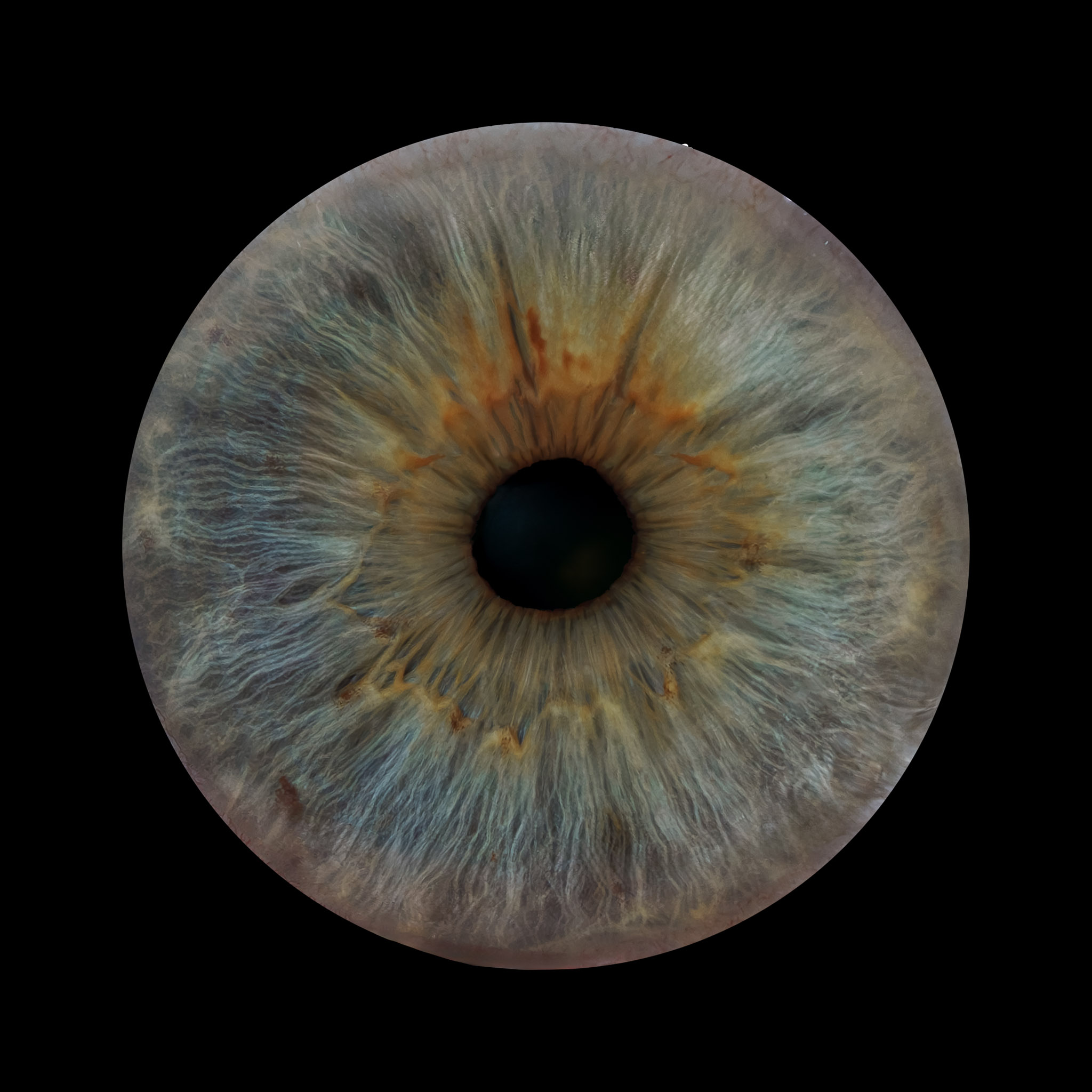 Iridographic eye photograph in print quality